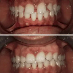 Real Smiles, Real Procedures