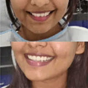 Real Smiles, Real Procedures