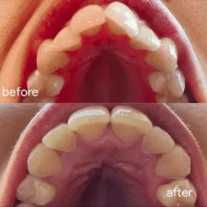 Real Smiles, Real Procedures