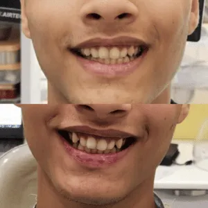 Real Smiles, Real Procedures