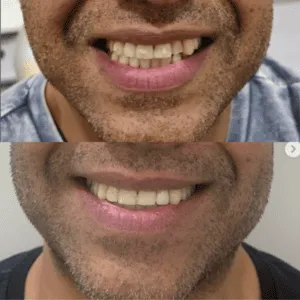 Real Smiles, Real Procedures