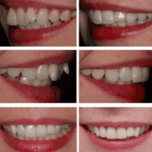 Real Smiles, Real Procedures