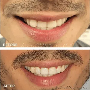 Real Smiles, Real Procedures