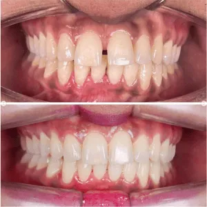 Real Smiles, Real Procedures