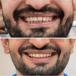 Real Smiles, Real Procedures