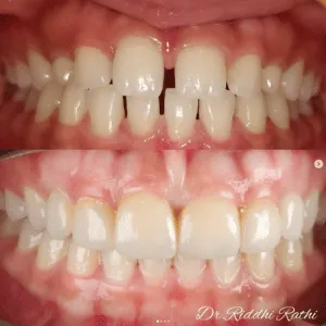 Real Smiles, Real Procedures