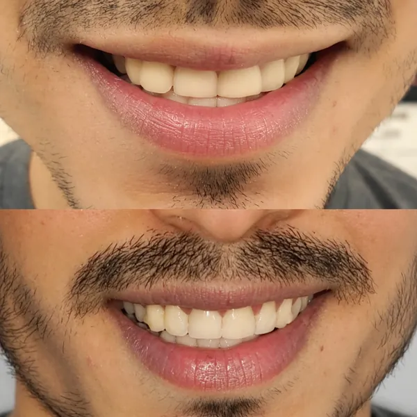 Real Smiles, Real Procedures