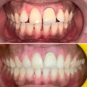 Real Smiles, Real Procedures