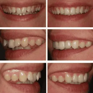 Real Smiles, Real Procedures