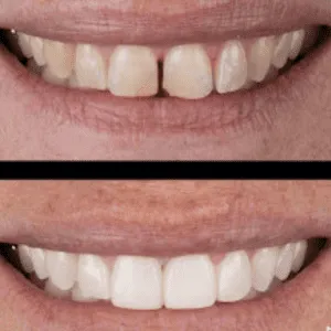 Real Smiles, Real Procedures