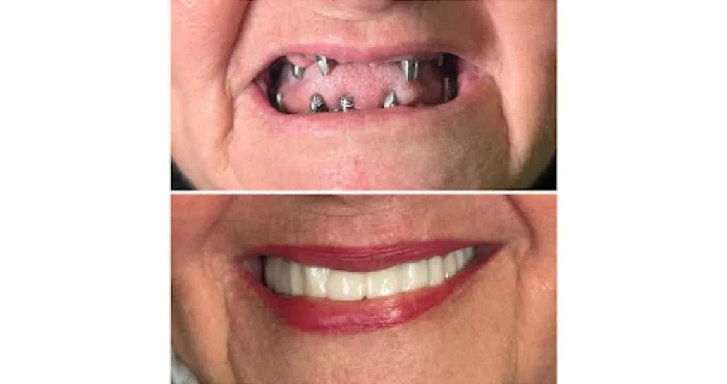 Real Smile Real Result Transformation