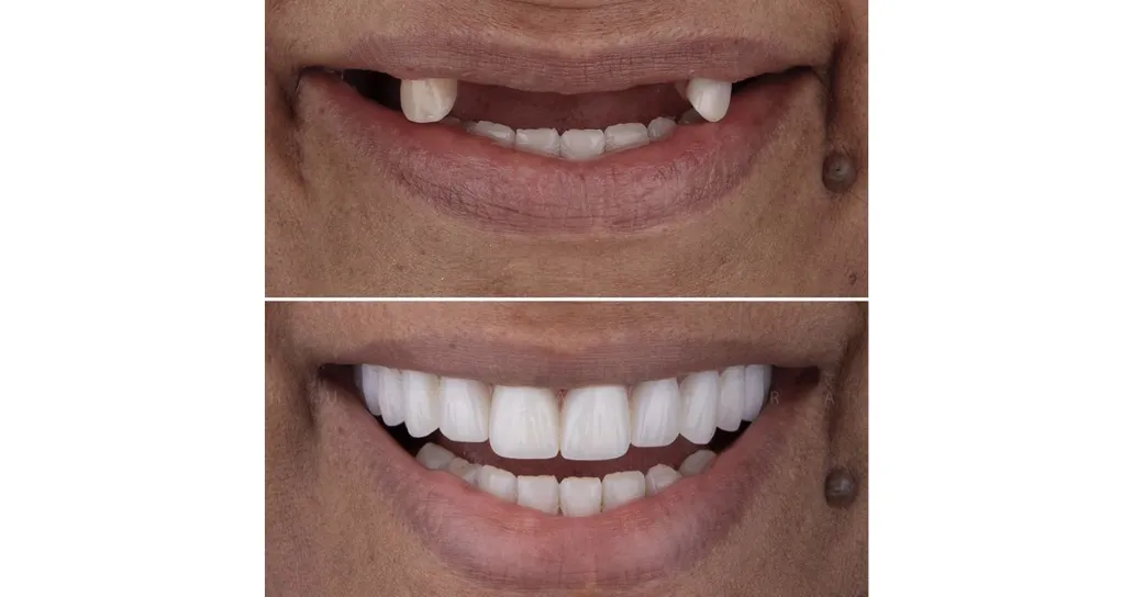 Real Smile Real Result Transformation