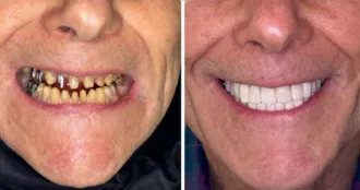 Real Smile Real Result Transformation