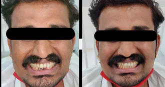 Real Smile Real Result Transformation