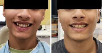 Real Smile Real Result Transformation
