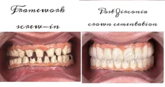 Real Smile Real Result Transformation