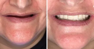 Real Smile Real Result Transformation