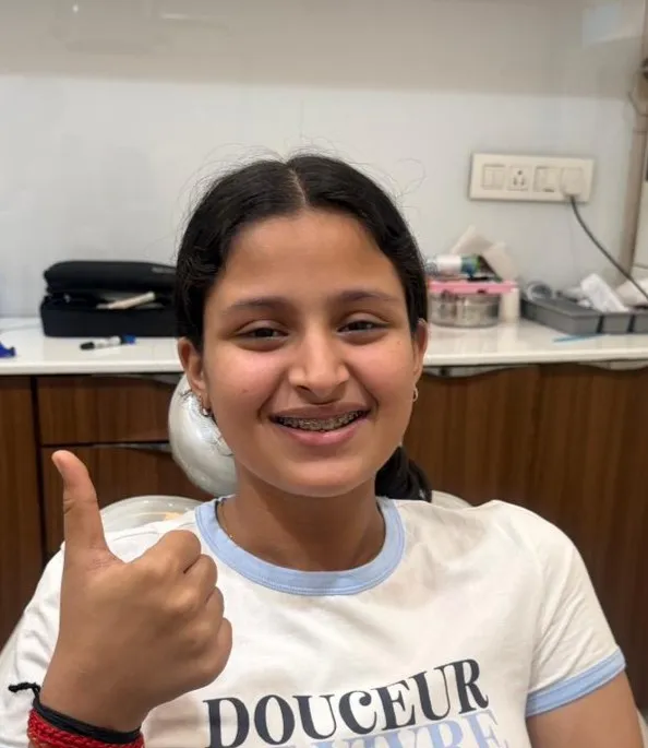 Kids dentistry before and after transformation
