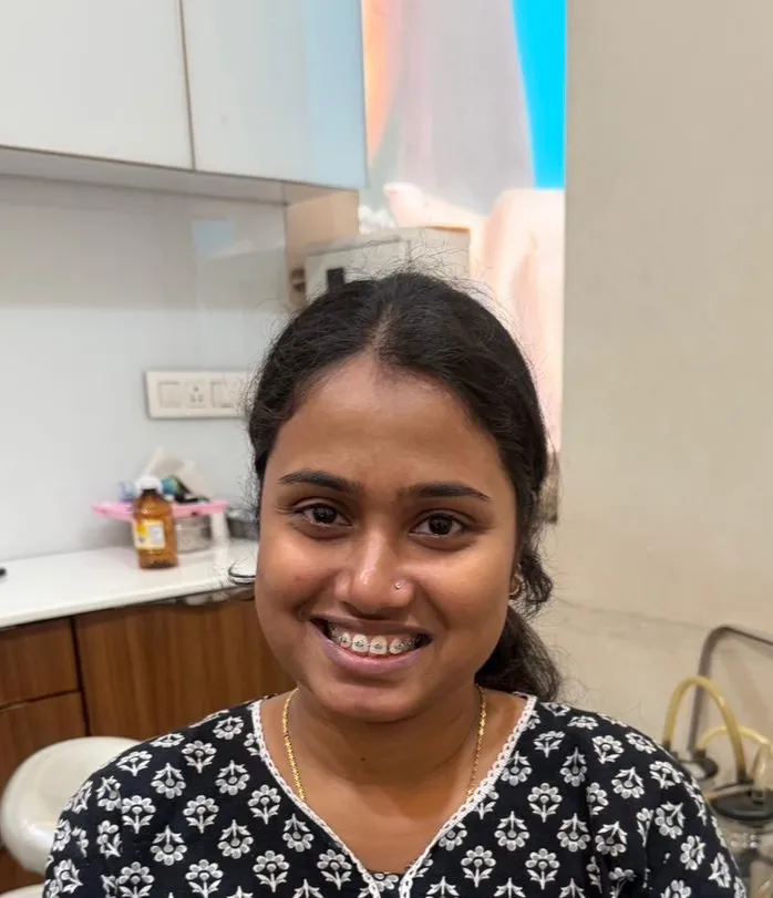 Kids dentistry before and after transformation