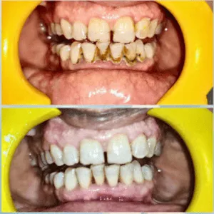 Scaling and cleaning before and after transformation