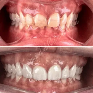 Scaling and cleaning before and after transformation