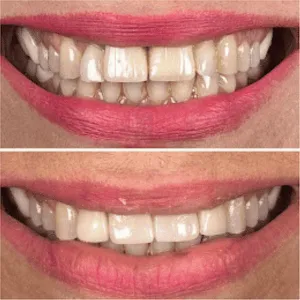 Scaling and cleaning before and after transformation
