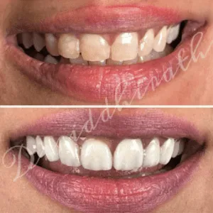 Scaling and cleaning before and after transformation