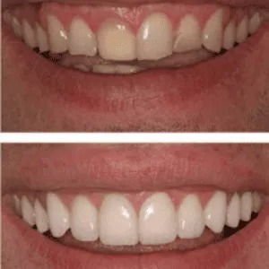 Scaling and cleaning before and after transformation