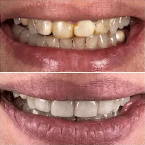 Scaling and cleaning before and after transformation