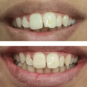 Real Smile Real Result Transformation