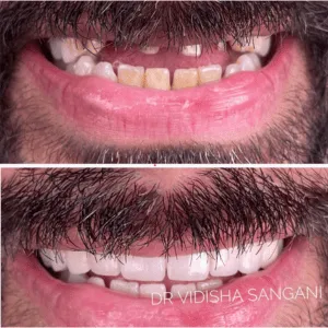 Real Smile Real Result Transformation