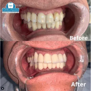Real Smile Real Result Transformation