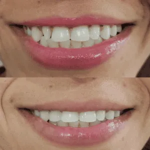 Real Smile Real Result Transformation