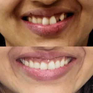 Real Smile Real Result Transformation