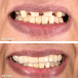 Real Smile Real Result Transformation