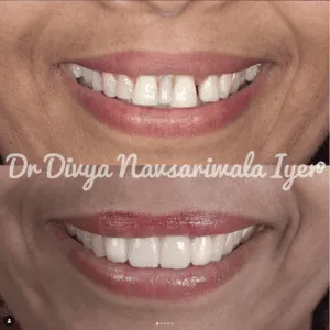 Real Smile Real Result Transformation
