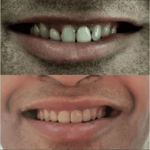 Real Smile Real Result Transformation