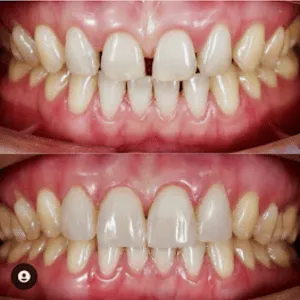 Real Smile Real Result Transformation