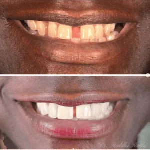 Real Smile Real Result Transformation