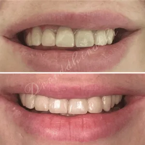 Real Smile Real Result Transformation