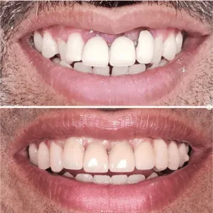 Real Smile Real Result Transformation