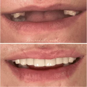 Real Smile Real Result Transformation