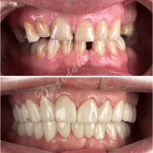 Real Smile Real Result Transformation