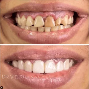 Real Smile Real Result Transformation