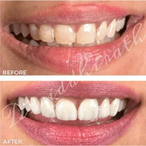 Real Smile Real Result Transformation