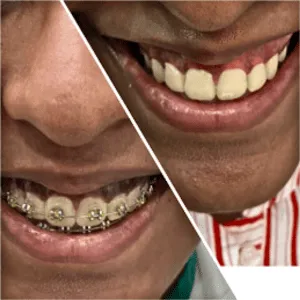 Real Smiles, Real Procedures