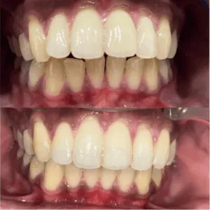 Real Smiles, Real Procedures
