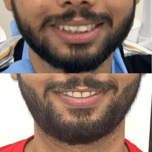 Real Smiles, Real Procedures