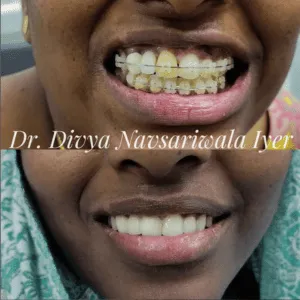 Real Smiles, Real Procedures