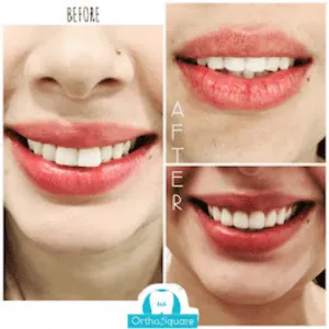 Real Smiles, Real Procedures